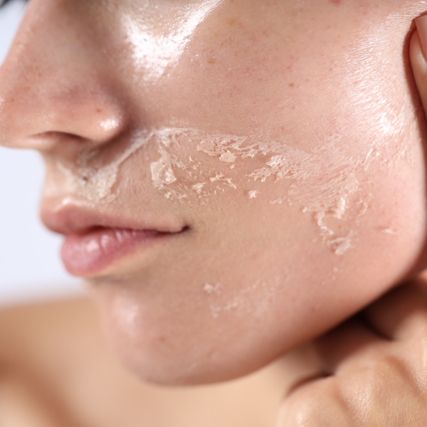 Dry Skin