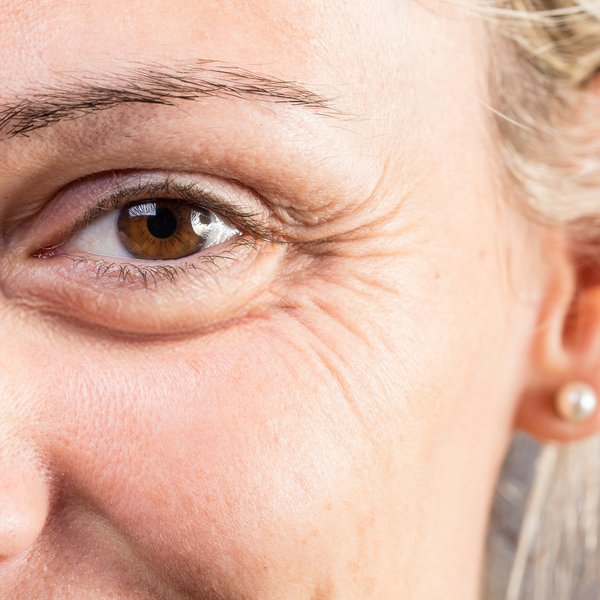 Wrinkles