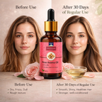 Rose Aroma Oil – 100% Pure Natural Essential Oil for Relaxation, Mood Uplift & Aromatherapy