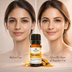 Turmeric Oil- An Essential Oil for a Glowing Skin