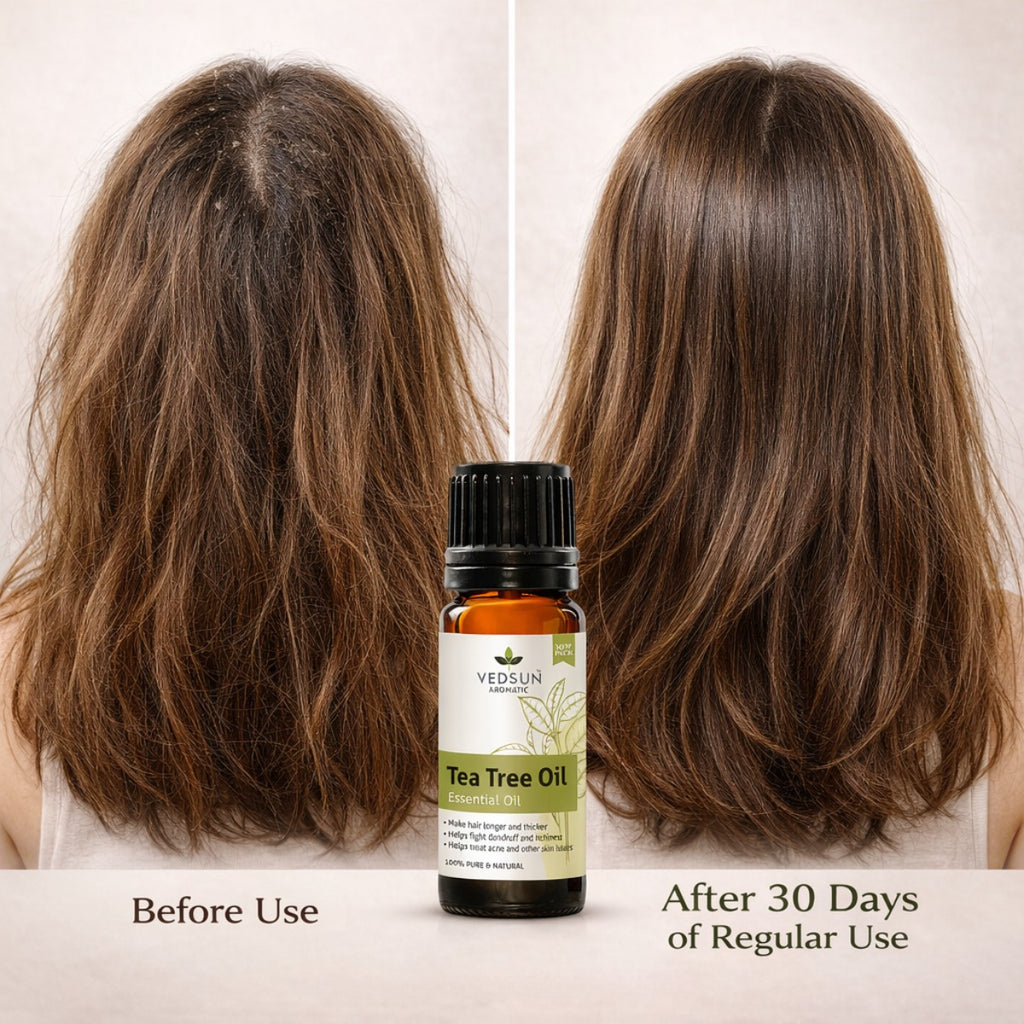 Tea Tree Oil 100% natural - Treat Acne and Other Skin Issues
