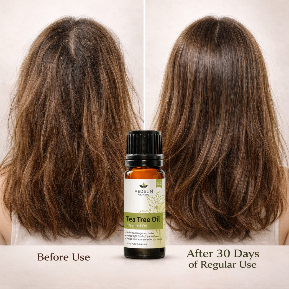 Tea Tree Oil 100% natural - Treat Acne and Other Skin Issues