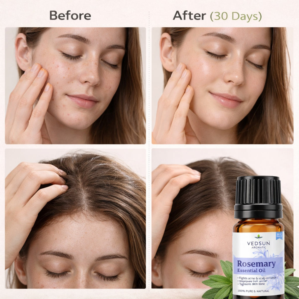 Rosemary Oil by Vedsun – 100% Pure Essential Oil for Hair Growth, Dandruff & Scalp Care