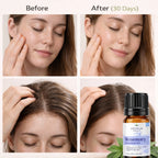 Rosemary Oil by Vedsun – 100% Pure Essential Oil for Hair Growth, Dandruff & Scalp Care