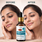 Radish Seed Oil by Vedsun – 100% Pure Mooli Beej Oil for Hair Growth, Hair Fall & Dandruff Control
