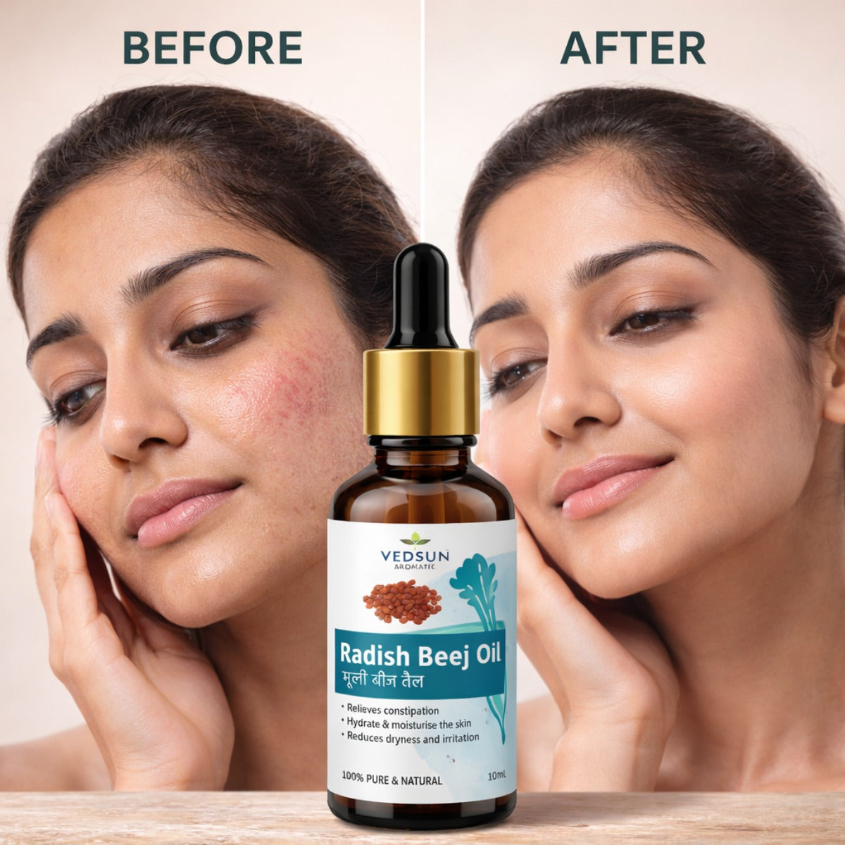 Radish Seed Oil by Vedsun – 100% Pure Mooli Beej Oil for Hair Growth, Hair Fall & Dandruff Control