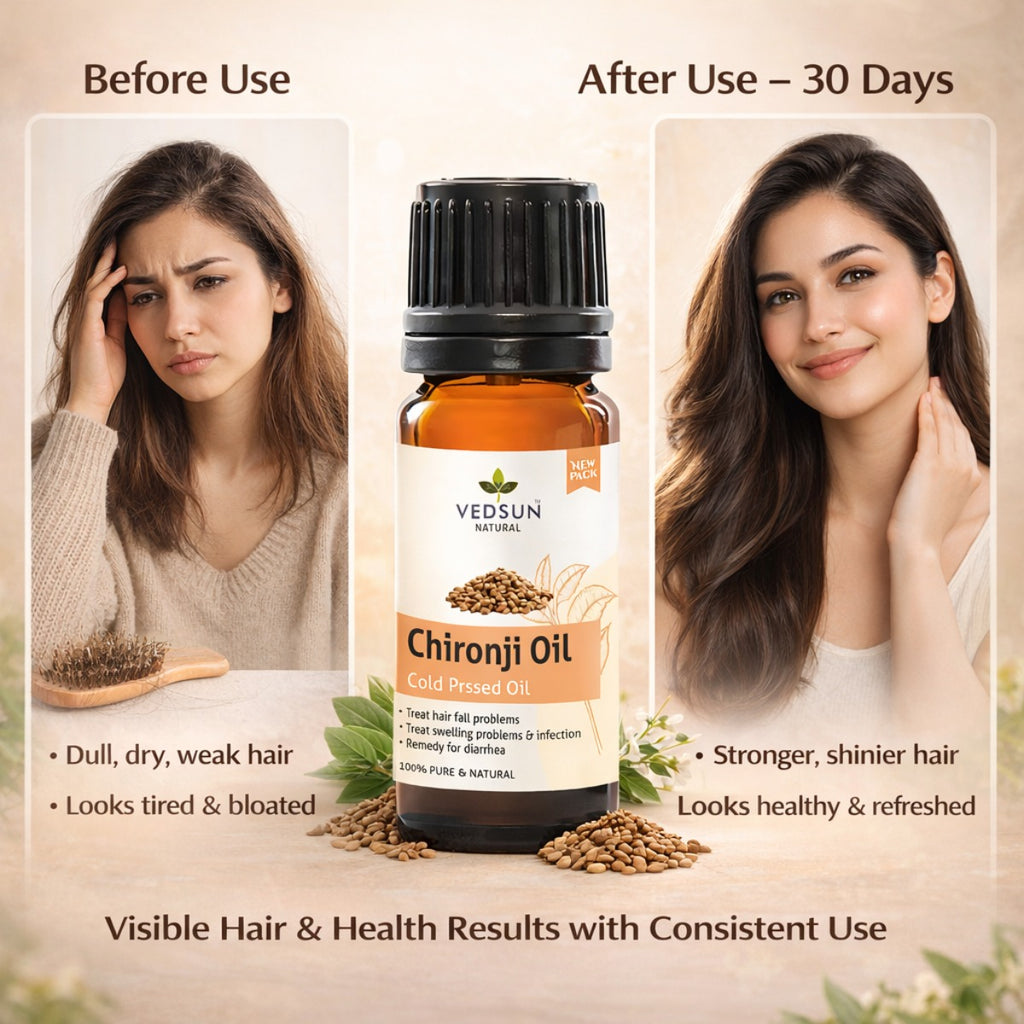 Chironji Oil by Vedsun – 100% Pure Ayurvedic Oil for Skin Nourishment & Glow