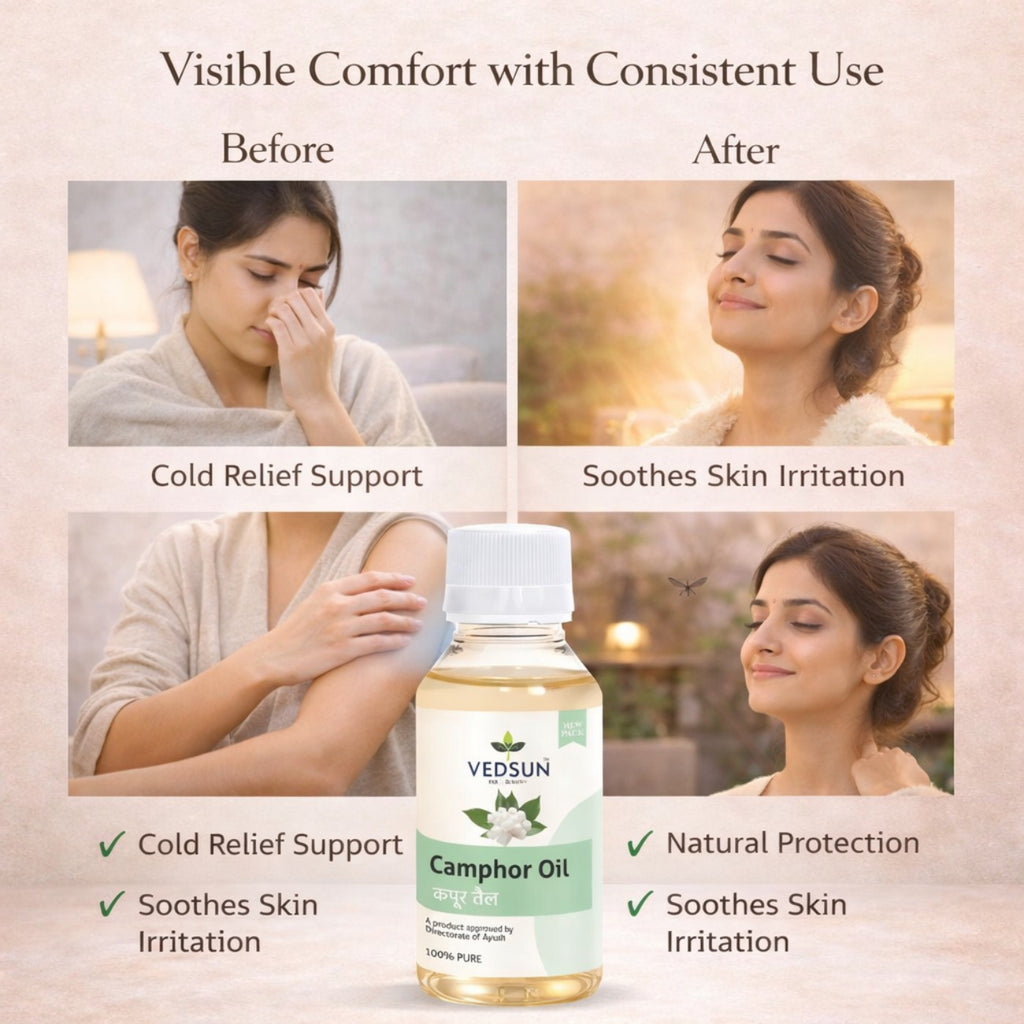 Camphor Oil by Vedsun – 100% Pure Kapoor Oil for Pain Relief, Cold & Respiratory Support