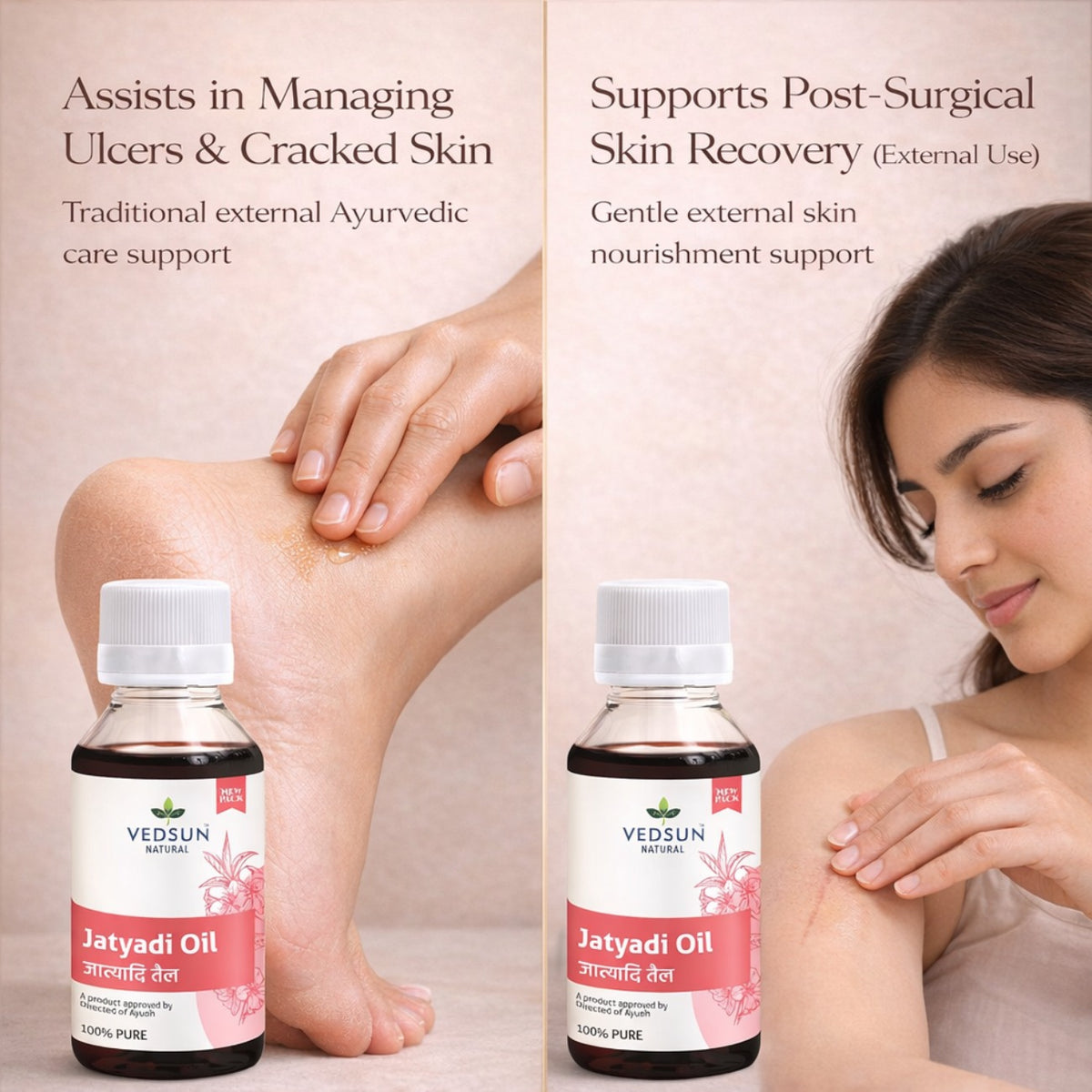 Jatyadi Oil by Vedsun – 100% Pure Ayurvedic Oil for Skin Healing & Wound Care