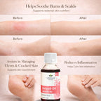 Jatyadi Oil by Vedsun – 100% Pure Ayurvedic Oil for Skin Healing & Wound Care