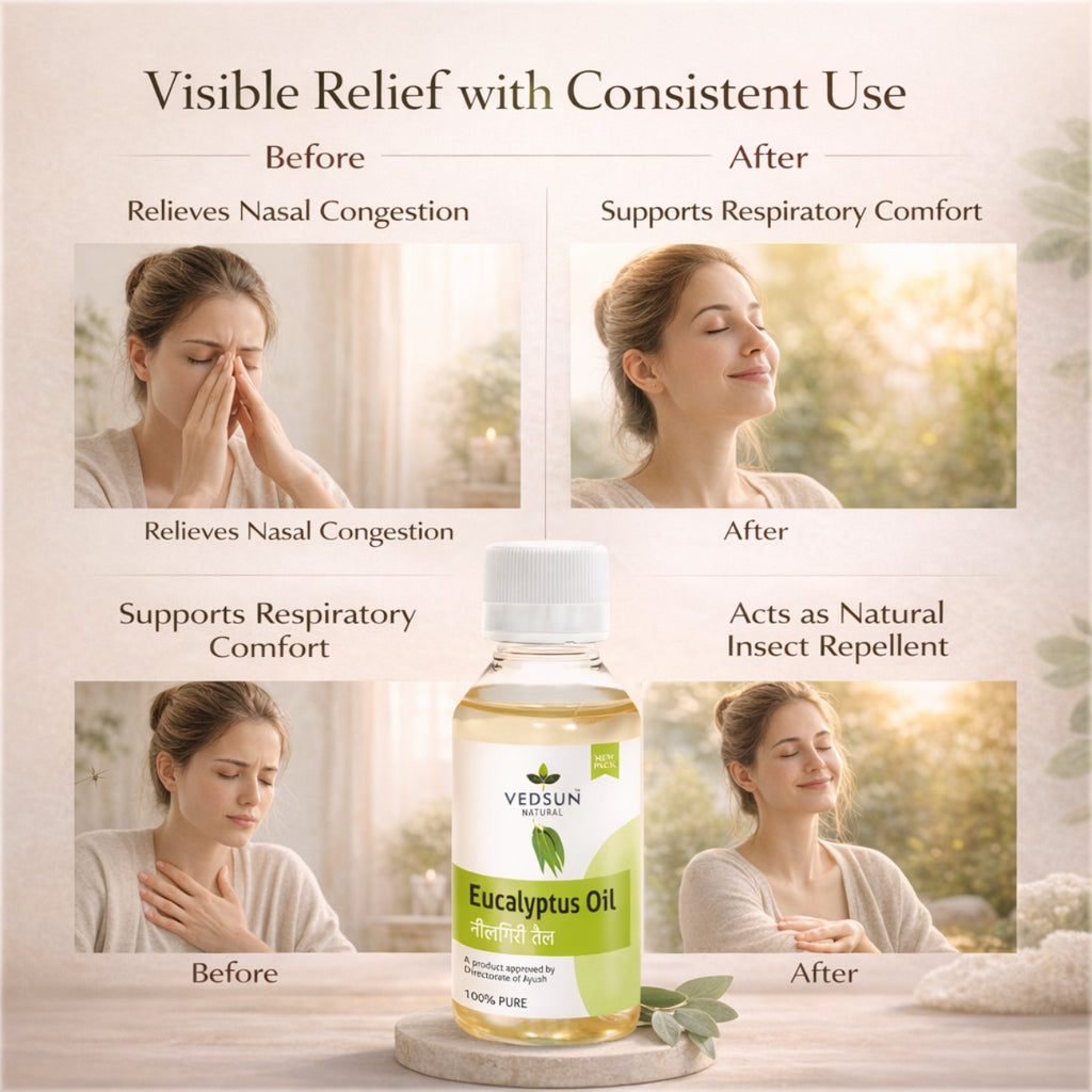 Eucalyptus Oil by Vedsun – 100% Pure Essential Oil for Cold, Pain Relief & Respiratory Support