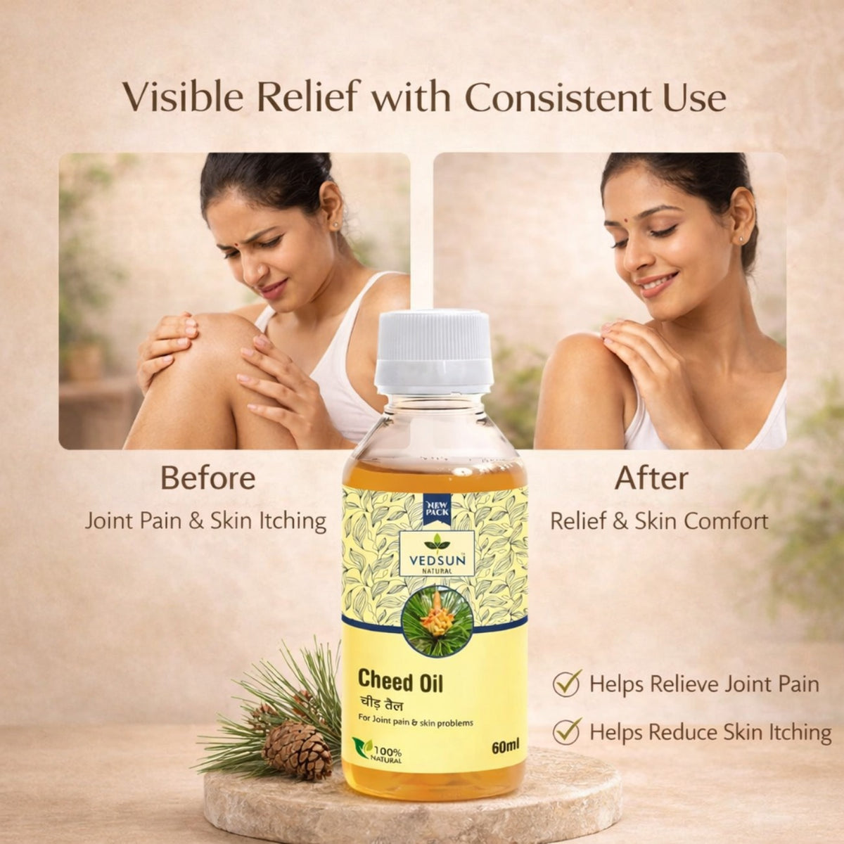 Cheed Oil by Vedsun – 100% Pure Pine Essential  Oil for Cleaning, Aromatherapy & Wellness