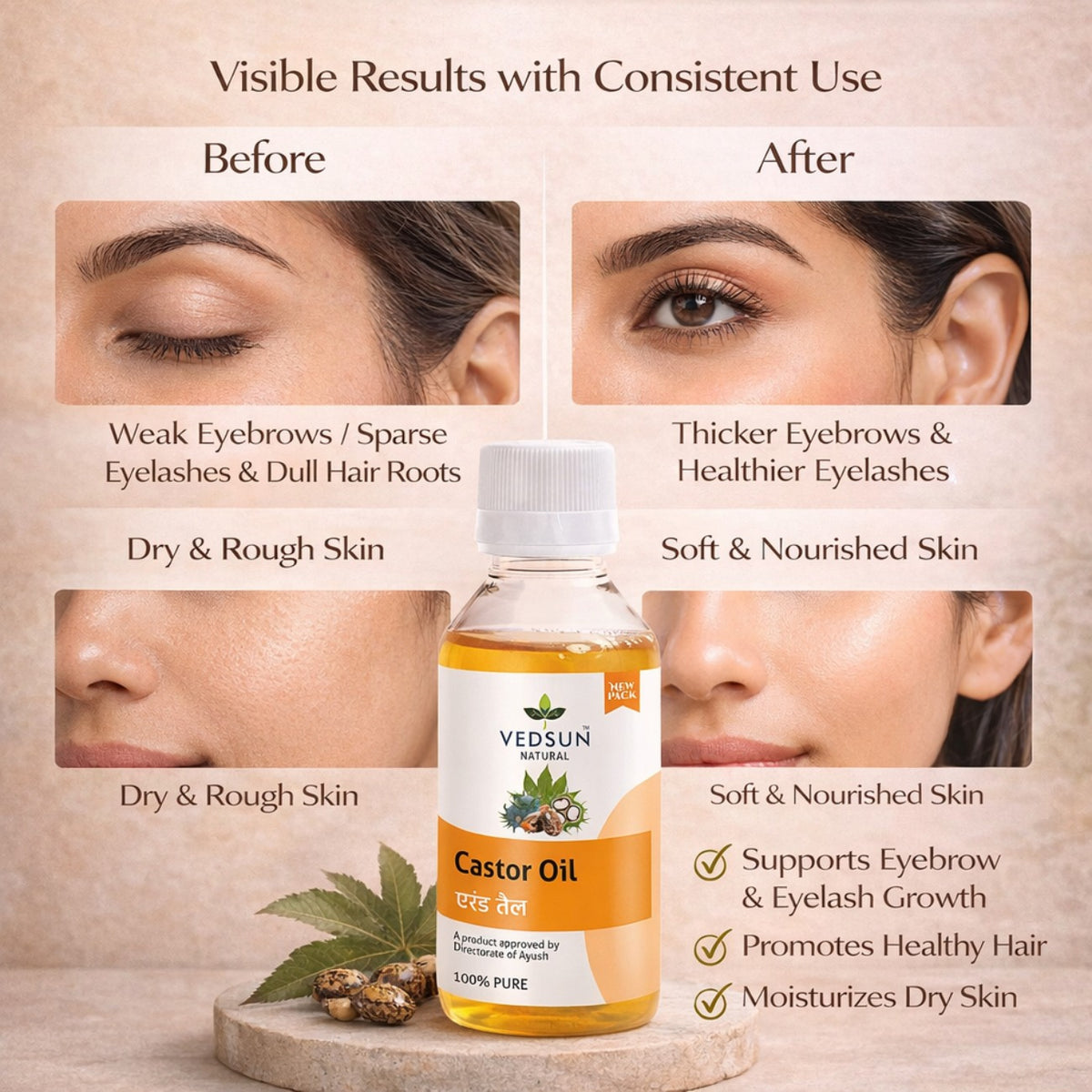 Castor Oil by Vedsun – 100% Pure Cold Pressed Oil for Hair Growth & Skin Nourishment