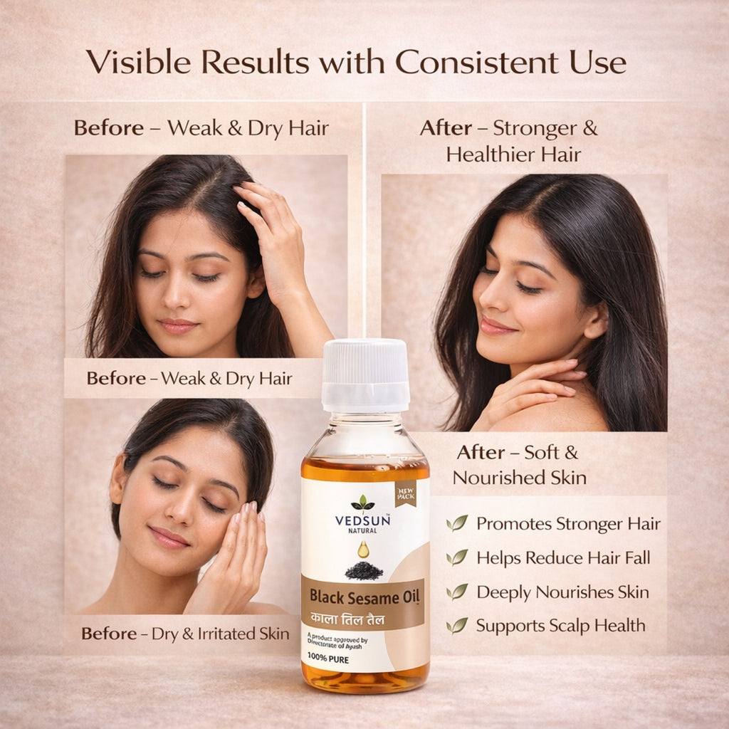 Black Sesame Oil – Natural Cold Pressed Black Til Oil for Abhyanga, Joint Care & Body Massage