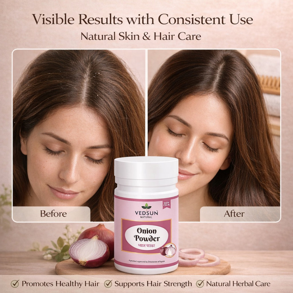 Onion Powder by Vedsun – 100% Pure Natural Hair Growth & Hair Fall Control Powder