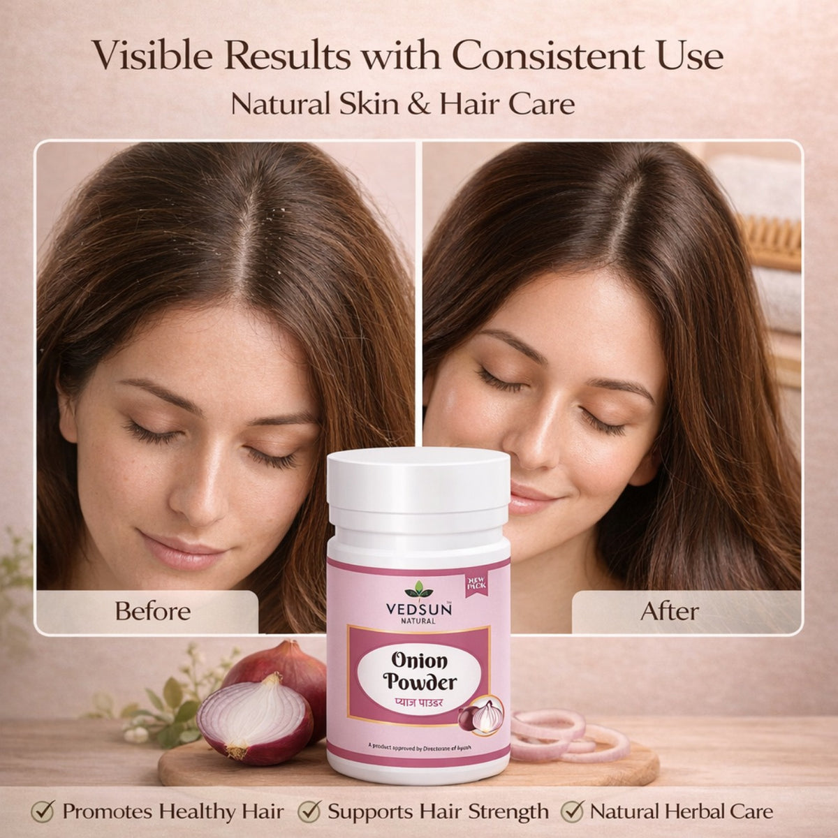 Onion Powder by Vedsun – 100% Pure Natural Hair Growth & Hair Fall Control Powder