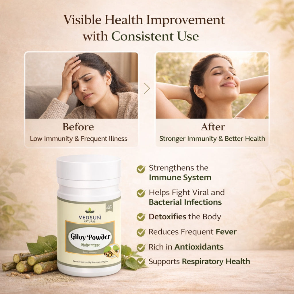 Giloy Powder by Vedsun – 100% Pure Guduchi Powder for Immunity & Detox Support