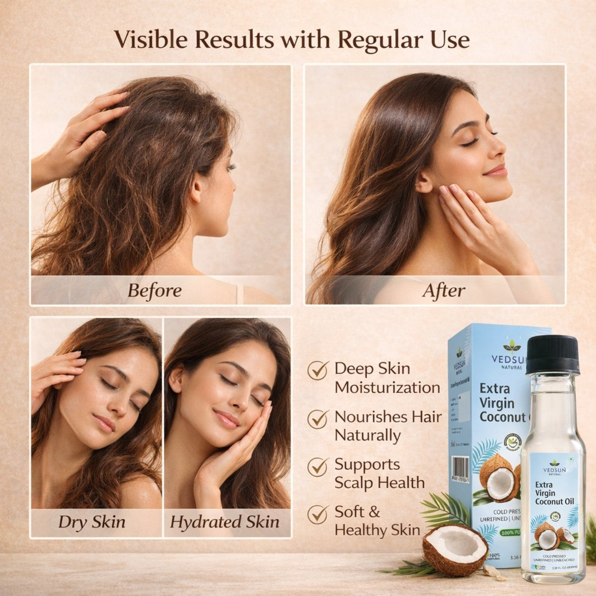 Extra Virgin Coconut Oil by Vedsun – Pure Cold Pressed Oil for Hair, Skin & Wellness