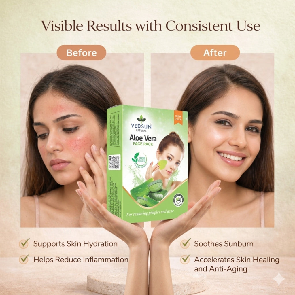 Vedsun Aloe Vera Face Pack – Cooling Face Mask for Acne, Irritated Skin & Skin Repair