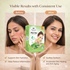 Vedsun Aloe Vera Face Pack – Cooling Face Mask for Acne, Irritated Skin & Skin Repair