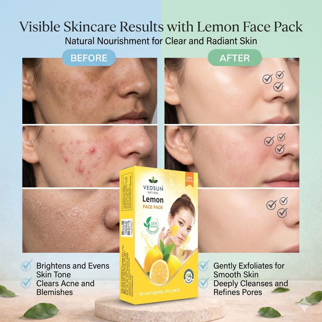 Vedsun Lemon Face Pack – Natural Face Mask for Tan Removal, Oil Control & Bright Glowing Skin